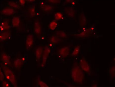 ICC/IF analysis of U2OS cells using GTX33390 PCCB antibody. Blue : DAPI