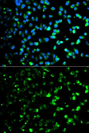 ICC/IF analysis of HeLa cells using GTX33396 Thymidine Phosphorylase antibody. Blue : DAPI