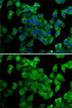 ICC/IF analysis of MCF7 cells using GTX33403 Periplakin antibody. Blue : DAPI