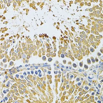 IHC-P analysis of rat testis tissue using GTX33409 PIBF1 antibody. Dilution : 1:200