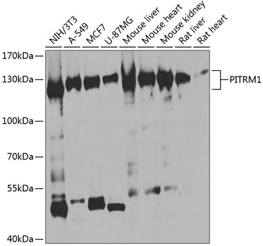 WB analysis of various sample lysates using GTX33412 PITRM1 antibody. Dilution : 1:1000 Loading : 25microg per lane WB analysis of various sample lysates using GTX33412 PITRM1 antibody. Dilution : 1:1000 Loading : 25microg per lane