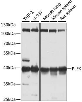 WB analysis of various sample lysates using GTX33414 Pleckstrin antibody. Dilution : 1:1000 Loading : 25microg per lane WB analysis of various sample lysates using GTX33414 Pleckstrin antibody. Dilution : 1:1000 Loading : 25microg per lane