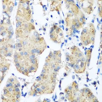 IHC-P analysis of human stomach tissue using GTX33414 Pleckstrin antibody. Dilution : 1:200