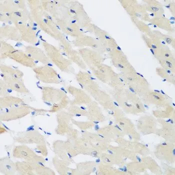IHC-P analysis of rat heart tissue using GTX33414 Pleckstrin antibody. Dilution : 1:200