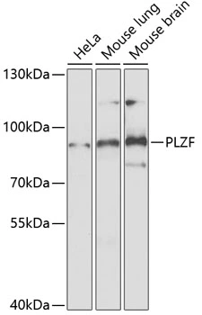 WB analysis of various sample lysates using GTX33417 PLZF antibody. Dilution : 1:1000 Loading : 25microg per lane WB analysis of various sample lysates using GTX33417 PLZF antibody. Dilution : 1:1000 Loading : 25microg per lane