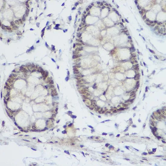 IHC-P analysis of human colon tissue using GTX33417 PLZF antibody. Dilution : 1:200