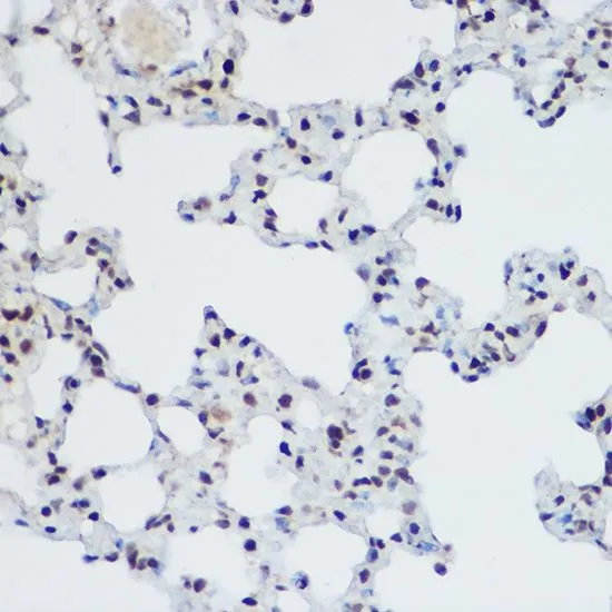 IHC-P analysis of mouse lung tissue using GTX33417 PLZF antibody. Dilution : 1:200