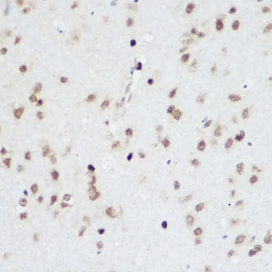 IHC-P analysis of rat brain tissue using GTX33417 PLZF antibody. Dilution : 1:200