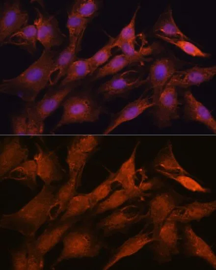 ICC/IF analysis of C6 cells using GTX33423 PPM1A antibody. Blue : DAPI Dilution : 1:100