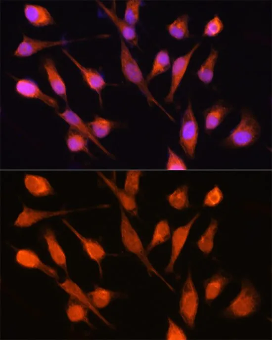ICC/IF analysis of HeLa cells using GTX33423 PPM1A antibody. Blue : DAPI Dilution : 1:100