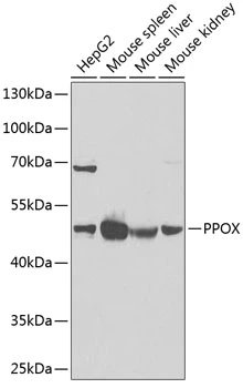 WB analysis of various sample lysates using GTX33424 PPOX antibody. The signal was developed with ECL plus-Enhanced. Dilution : 1:1000 Loading : 25microg per lane WB analysis of various sample lysates using GTX33424 PPOX antibody. The signal was developed with ECL plus-Enhanced. Dilution : 1:1000 Loading : 25microg per lane