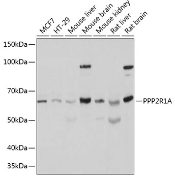 WB analysis of various sample lysates using GTX33425 PPP2R1A antibody. Dilution : 1:500 Loading : 25microg per lane WB analysis of various sample lysates using GTX33425 PPP2R1A antibody. Dilution : 1:500 Loading : 25microg per lane
