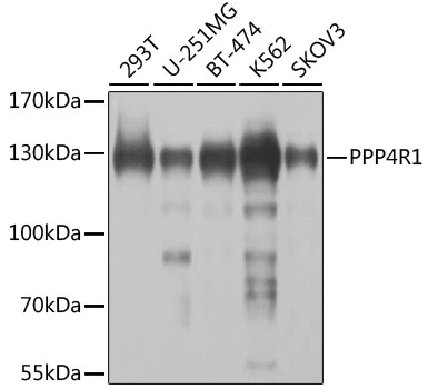 WB analysis of various sample lysates using GTX33426 PPP4R1 antibody. Dilution : 1:1000 Loading : 25microg per lane