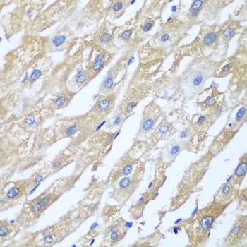 IHC-P analysis of human liver tissue using GTX33426 PPP4R1 antibody. Dilution : 1:100