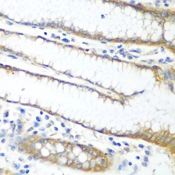 IHC-P analysis of human stomach tissue using GTX33426 PPP4R1 antibody. Dilution : 1:100