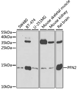 WB analysis of various sample lysates using GTX33429 Profilin 2 antibody. The signal was developed with ECL plus-Enhanced. Dilution : 1:500 Loading : 25microg per lane WB analysis of various sample lysates using GTX33429 Profilin 2 antibody. The signal was developed with ECL plus-Enhanced. Dilution : 1:500 Loading : 25microg per lane