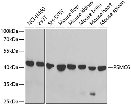 WB analysis of various sample lysates using GTX33436 PSMC6 antibody. Dilution : 1:1000 Loading : 25microg per lane WB analysis of various sample lysates using GTX33436 PSMC6 antibody. Dilution : 1:1000 Loading : 25microg per lane