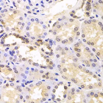IHC-P analysis of human kidney tissue using GTX33436 PSMC6 antibody. Dilution : 1:100