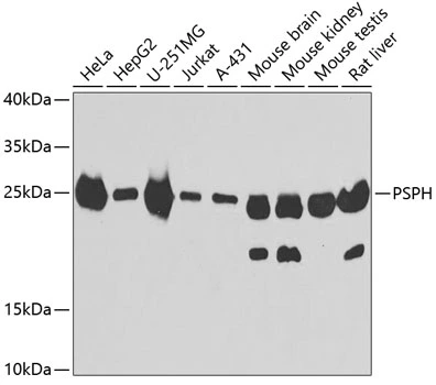 WB analysis of various sample lysates using GTX33442 PSPH antibody. Dilution : 1:1000 Loading : 25microg per lane WB analysis of various sample lysates using GTX33442 PSPH antibody. Dilution : 1:1000 Loading : 25microg per lane