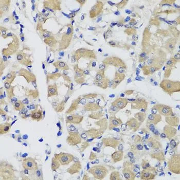 IHC-P analysis of human stomach tissue using GTX33442 PSPH antibody. Dilution : 1:100