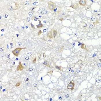 IHC-P analysis of rat brain tissue using GTX33442 PSPH antibody. Dilution : 1:100
