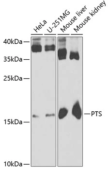 WB analysis of various sample lysates using GTX33445 PTS antibody. Dilution : 1:1000 Loading : 25microg per lane WB analysis of various sample lysates using GTX33445 PTS antibody. Dilution : 1:1000 Loading : 25microg per lane