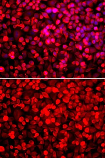 ICC/IF analysis of HeLa cells using GTX33446 PUF60 antibody. Blue : DAPI