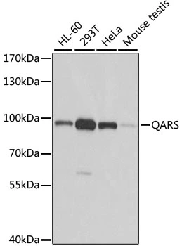 WB analysis of various sample lysates using GTX33449 QARS antibody. Dilution : 1:1000 Loading : 25microg per lane WB analysis of various sample lysates using GTX33449 QARS antibody. Dilution : 1:1000 Loading : 25microg per lane