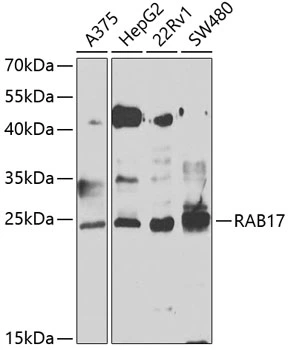 WB analysis of various sample lysates using GTX33451 RAB17 antibody. Dilution : 1:1000 Loading : 25microg per lane WB analysis of various sample lysates using GTX33451 RAB17 antibody. Dilution : 1:1000 Loading : 25microg per lane