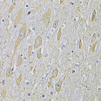 IHC-P analysis of mouse brain tissue using GTX33451 RAB17 antibody. Dilution : 1:100