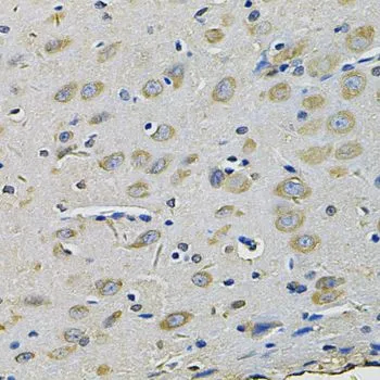 IHC-P analysis of rat brain tissue using GTX33451 RAB17 antibody. Dilution : 1:100