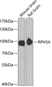 WB analysis of various sample lysates using GTX33452 Rabphilin 3A antibody. Dilution : 1:1000 Loading : 25microg per lane WB analysis of various sample lysates using GTX33452 Rabphilin 3A antibody. Dilution : 1:1000 Loading : 25microg per lane