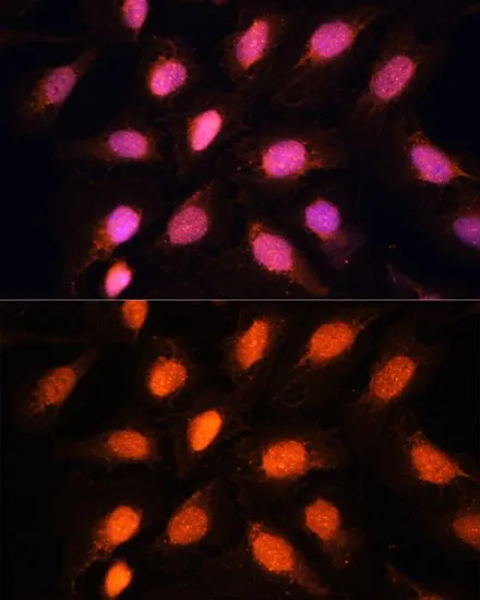 ICC/IF analysis of U2OS cells using GTX33458 RAP1 antibody. Blue : DAPI Dilution : 1:100