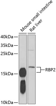 WB analysis of various sample lysates using GTX33462 RBP2 antibody. Dilution : 1:1000 Loading : 25microg per lane WB analysis of various sample lysates using GTX33462 RBP2 antibody. Dilution : 1:1000 Loading : 25microg per lane