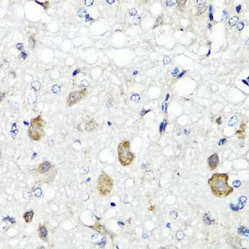 IHC-P analysis of rat brain tissue using GTX33462 RBP2 antibody. Dilution : 1:100