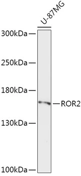 WB analysis of U-87MG cell lysate using GTX33470 ROR2 antibody. Dilution : 1:1000 Loading : 25microg per lane WB analysis of U-87MG cell lysate using GTX33470 ROR2 antibody. Dilution : 1:1000 Loading : 25microg per lane