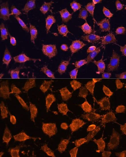 ICC/IF analysis of L929 cells using GTX33471 RPL11 antibody. Blue : DAPI Dilution : 1:100