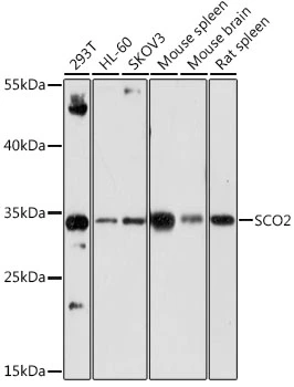WB analysis of various sample lysates using GTX33486 SCO2 antibody. The signal was developed with ECL plus-Enhanced. Dilution : 1:1000 Loading : 25microg per lane WB analysis of various sample lysates using GTX33486 SCO2 antibody. The signal was developed with ECL plus-Enhanced. Dilution : 1:1000 Loading : 25microg per lane