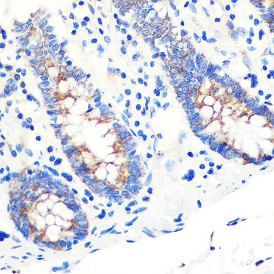 IHC-P analysis of human colon tissue using GTX33486 SCO2 antibody. Dilution : 1:100