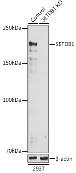 WB analysis of 293T cell lysate using GTX33492 SETDB1 antibody. Dilution : 1:1000 Loading : 25microg per lane WB analysis of 293T cell lysate using GTX33492 SETDB1 antibody. Dilution : 1:1000 Loading : 25microg per lane