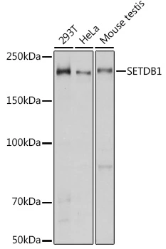 WB analysis of various sample lysates using GTX33492 SETDB1 antibody. Dilution : 1:1000 Loading : 25microg per lane