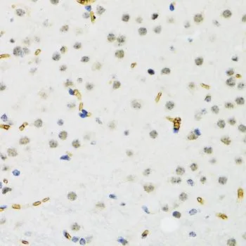 IHC-P analysis of rat brain tissue using GTX33492 SETDB1 antibody. Dilution : 1:100