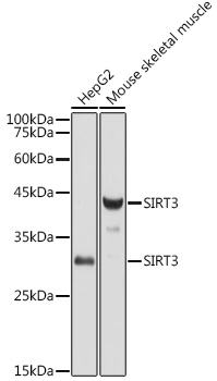 WB analysis of various sample lysates using GTX33499 SIRT3 antibody. Dilution : 1:1000 Loading : 25microg per lane