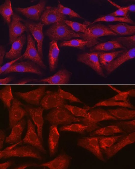 ICC/IF analysis of NIH/3T3 cells using GTX33499 SIRT3 antibody. Blue : DAPI Dilution : 1:100