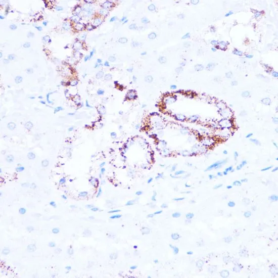 IHC-P analysis of rat kidney tissue using GTX33499 SIRT3 antibody. Dilution : 1:100