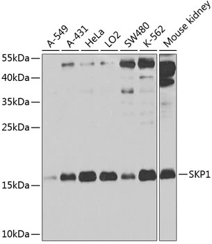 WB analysis of various sample lysates using GTX33502 SKP1 antibody. Dilution : 1:1000 Loading : 25microg per lane WB analysis of various sample lysates using GTX33502 SKP1 antibody. Dilution : 1:1000 Loading : 25microg per lane