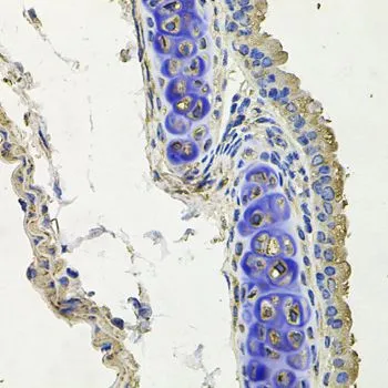 IHC-P analysis of mouse lung tissue using GTX33502 SKP1 antibody. Dilution : 1:100