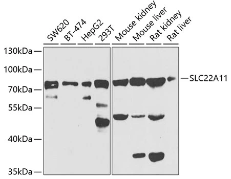 WB analysis of various sample lysates using GTX33503 SLC22A11 antibody. Dilution : 1:1000 Loading : 25microg per lane WB analysis of various sample lysates using GTX33503 SLC22A11 antibody. Dilution : 1:1000 Loading : 25microg per lane