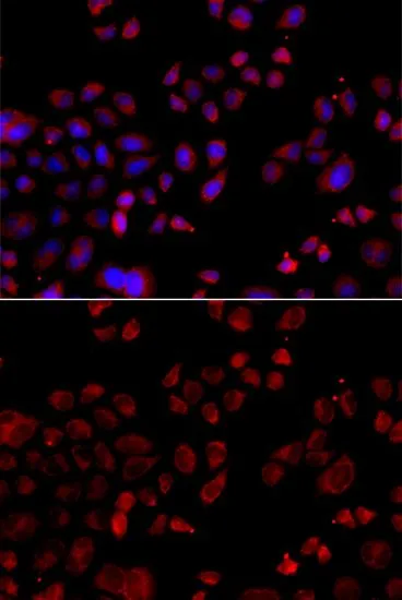 ICC/IF analysis of A549 cells using GTX33503 SLC22A11 antibody. Blue : DAPI