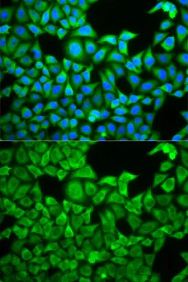 ICC/IF analysis of HeLa cells using GTX33506 SLC3A1 antibody. Blue : DAPI